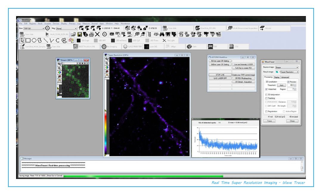 Real Time Super Resolution Imaging | ImagXcell
