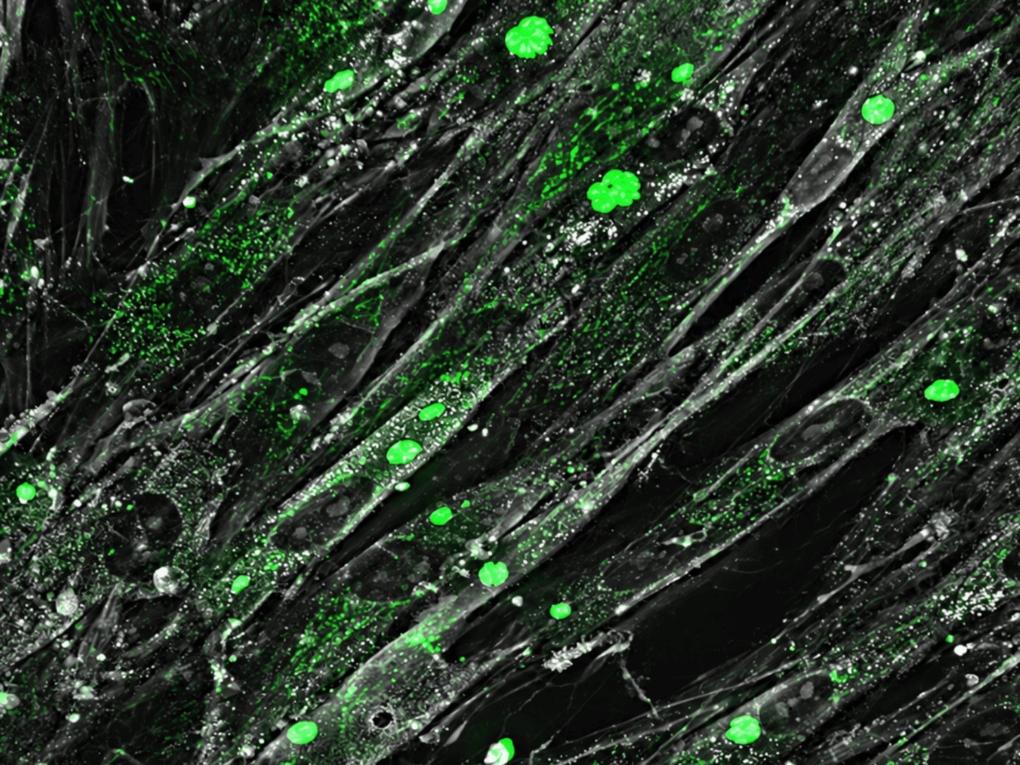 Fluorescence hôte-pathogène