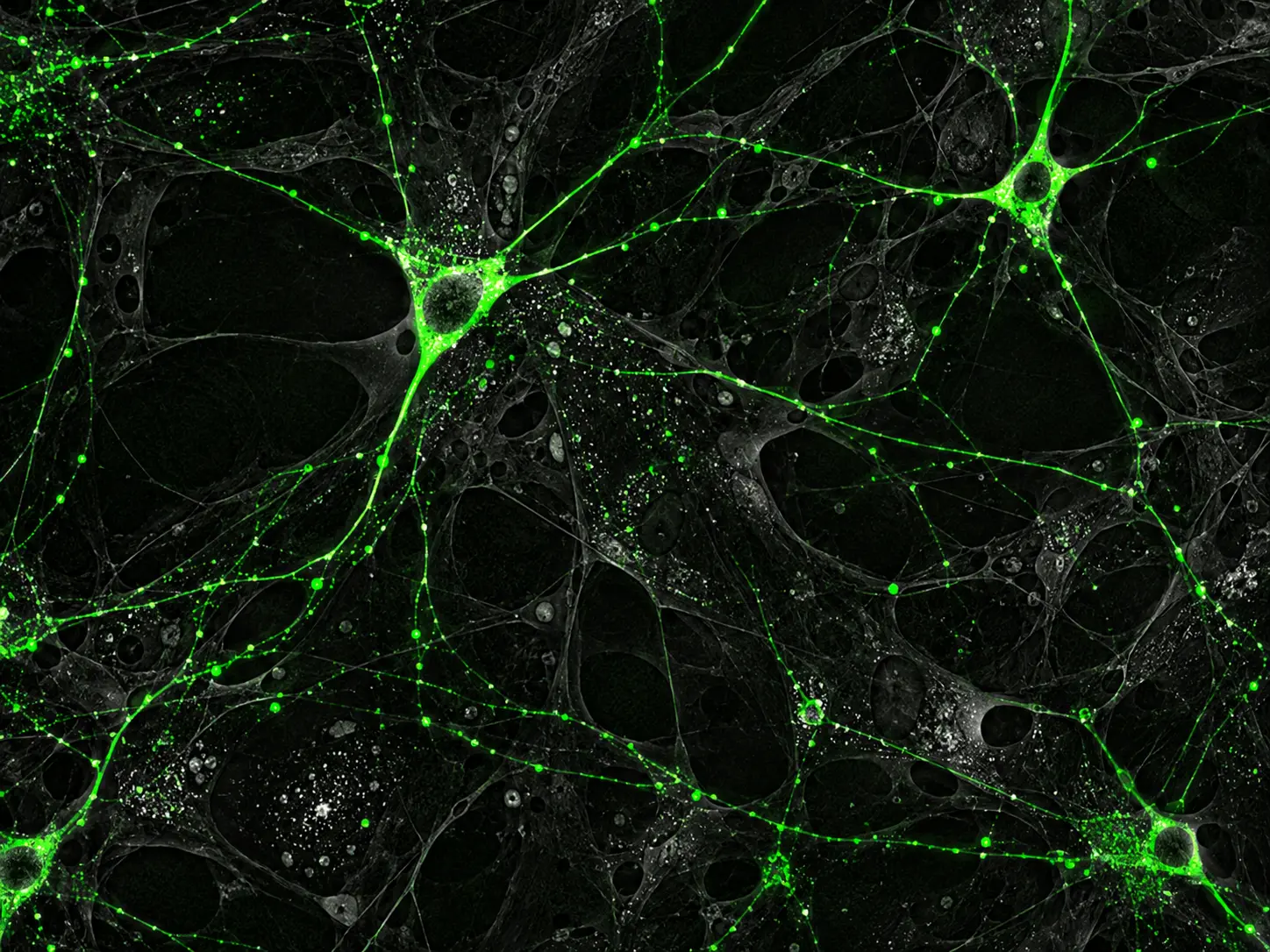 Image de fluorescence_Neurosciences