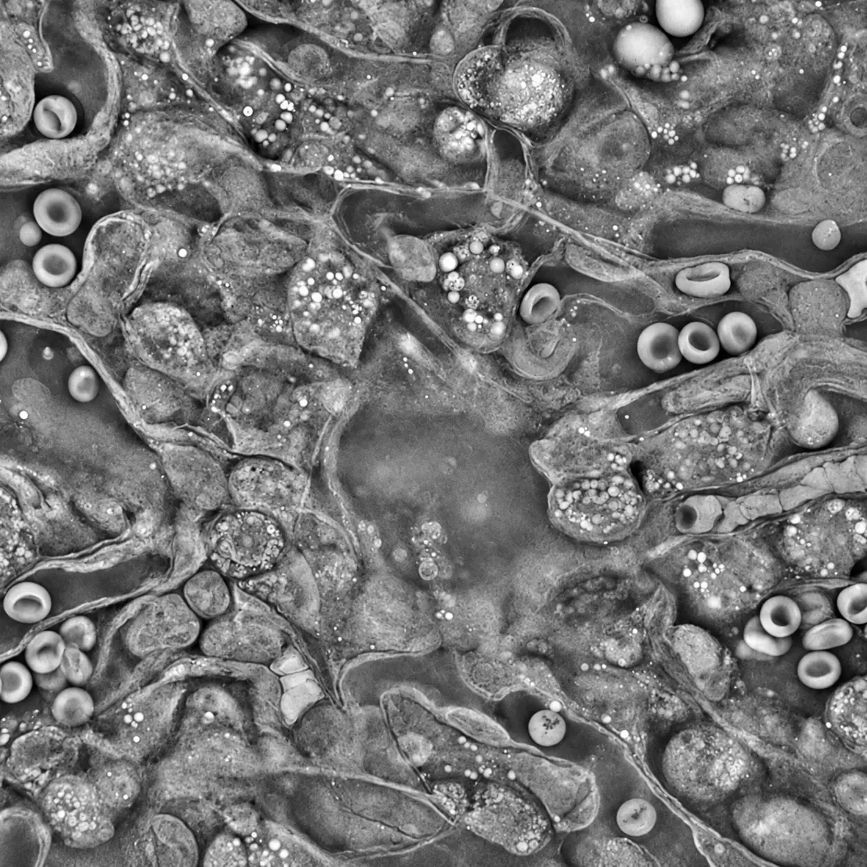 Vignette_Hematologie